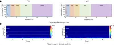 Diagnosis of Alzheimer’s disease via resting-state EEG: integration of spectrum, complexity, and synchronization signal features